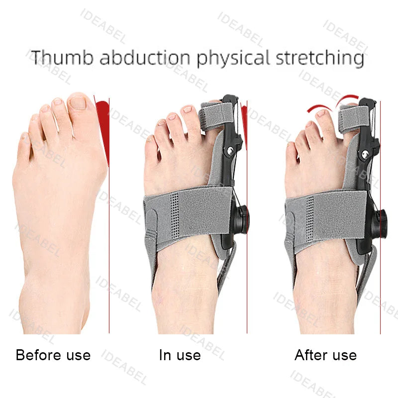 Toe Adjuster Orthotics Bone Thumb Adjustable Hammer Protector Hallux Valgus Adjuster Bunion Adjuster Orthopedic Tool Care