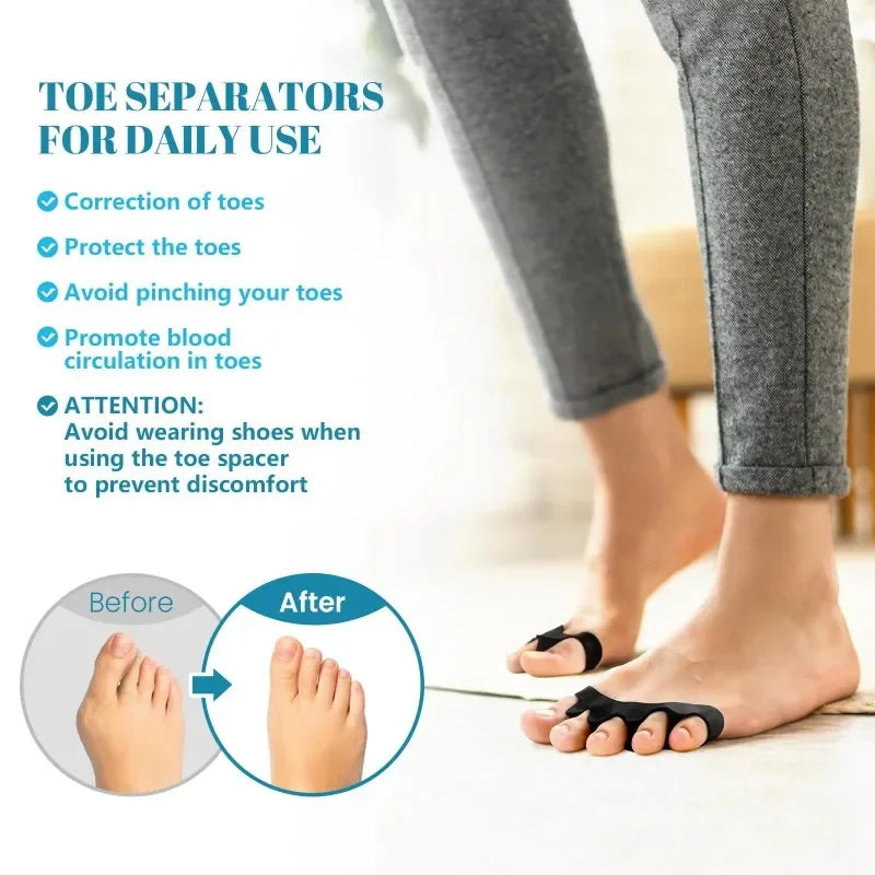 Silicone Toe Separators Toe Straightener for Bunion Relief, Overlapping Toes, Plantar Fasciitis, Foot Pain Correction
