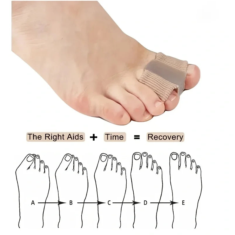 Bunion Aligner, Toe Alignment Splint for Women Men, Big Toe Spacers, Breathable