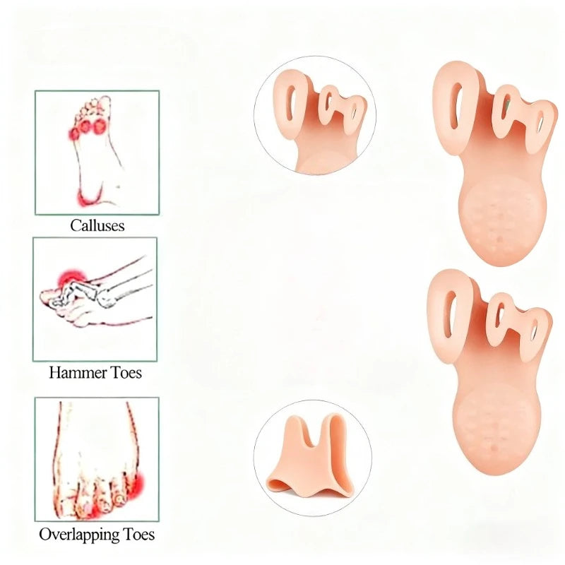 1pair  Gel Toe Separators & Ball of Foot Cushions Toe Spacers to Your Toes
